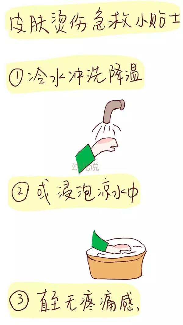 皮肤烫伤急救小贴士